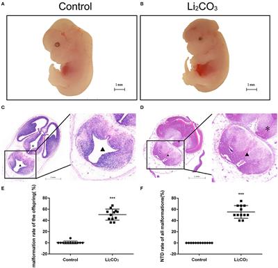 Down-Regulation of Inpp5e Associated With Abnormal Ciliogenesis During Embryonic Neurodevelopment Under Inositol Deficiency